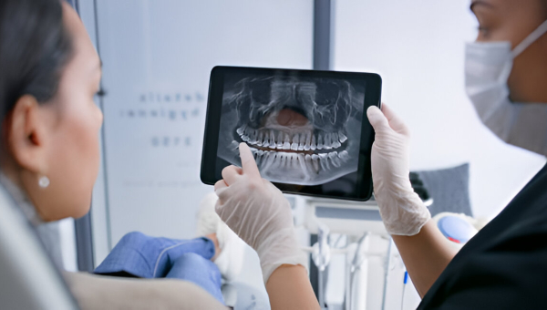 a dentist shows results of dental fillings in Houston at Gulfton Smiles